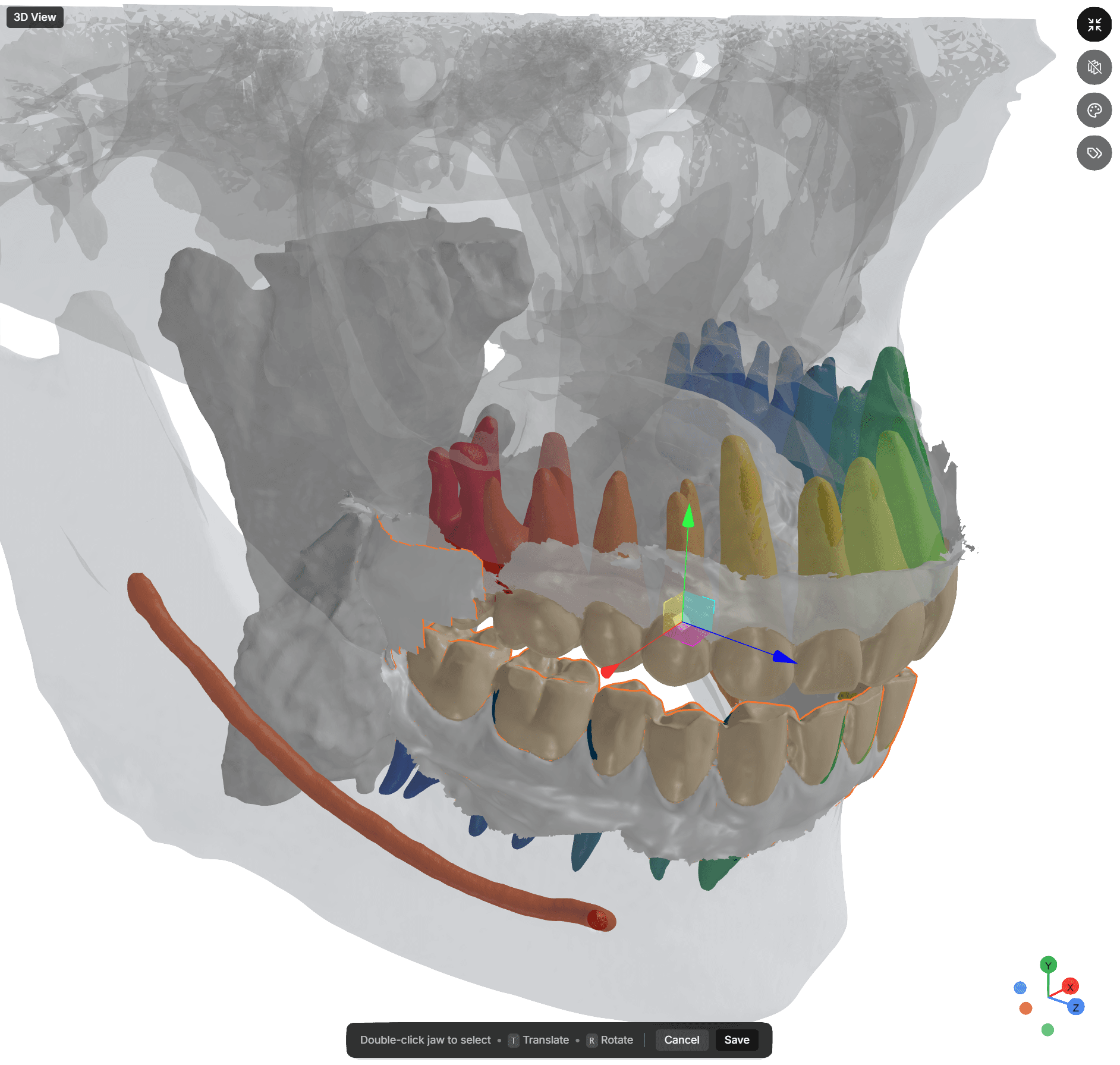 Fusion & Registration