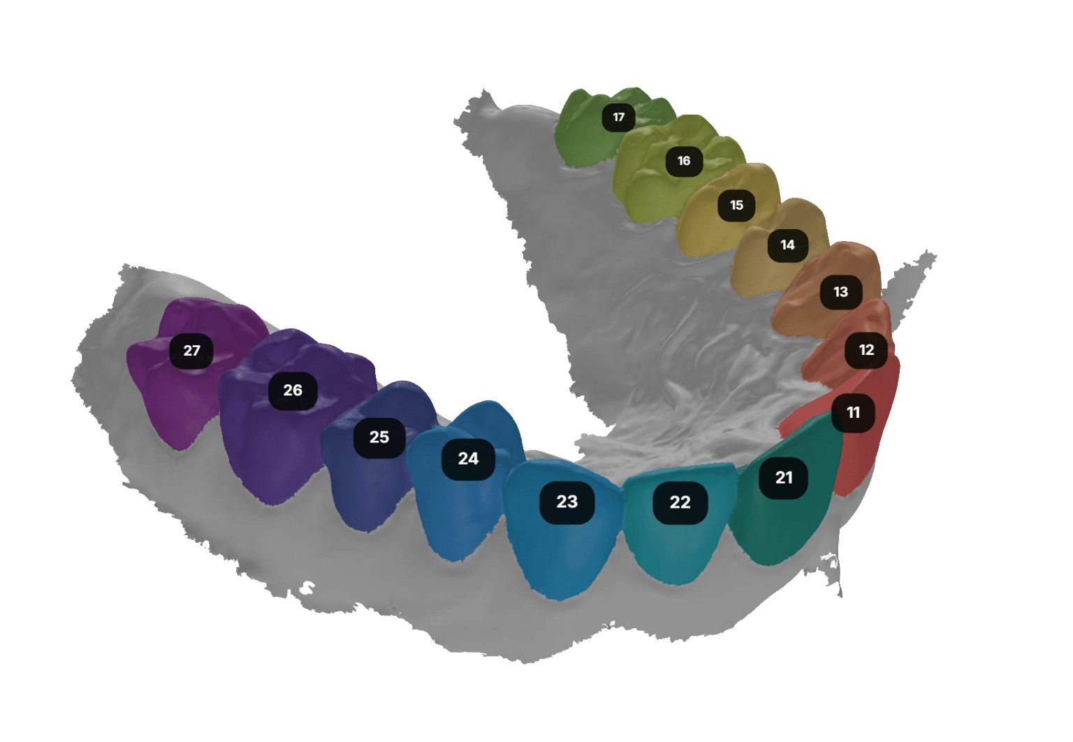Intraoral Scan Segmentation