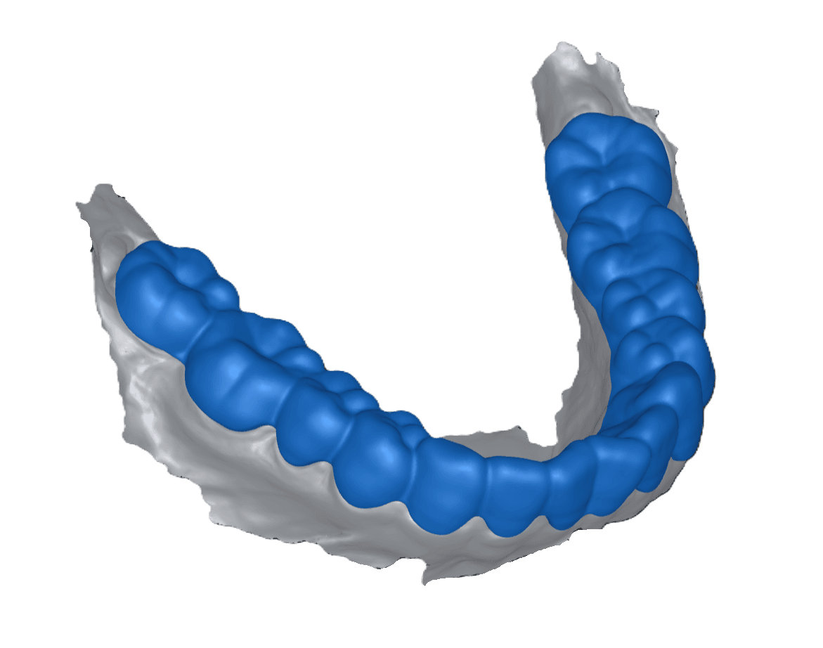 Retainer Models