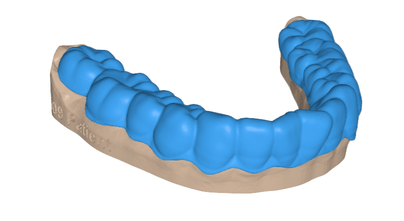 Production-Ready Retainer Model